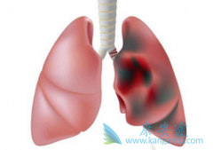 �˽����ڷΰ�֢״�Էΰ������ƺ���Ҫ