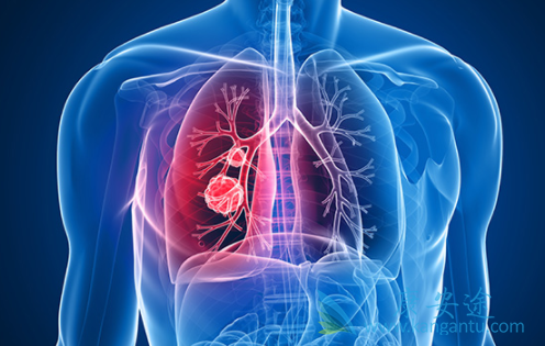 印度特罗凯 印度特罗凯