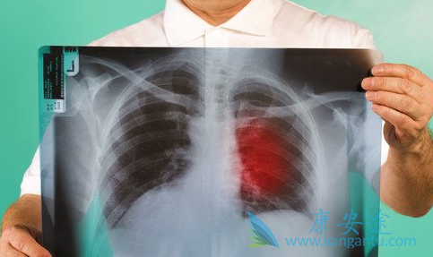 �ΰ�����