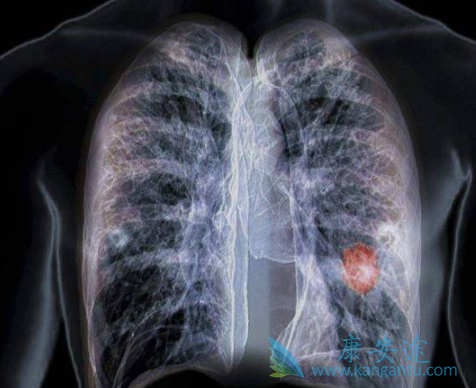 达克替尼 达克替尼