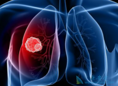 �ΰ�ҩ��������(Dacomitinib)���й���������