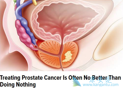 前列腺癌 前列腺癌