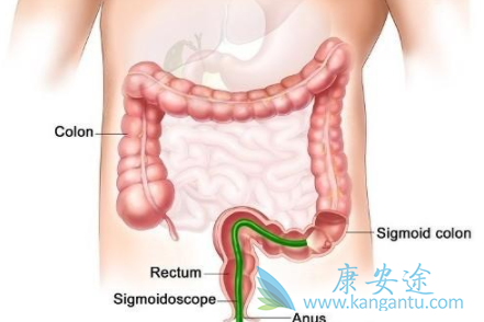 安罗替尼 安罗替尼