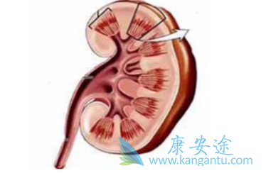 �������ὺ��