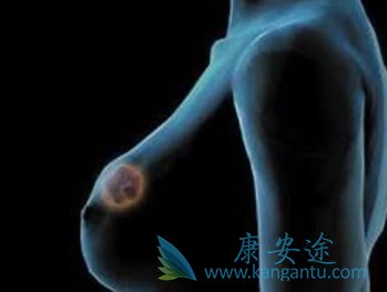 拉帕替尼 拉帕替尼