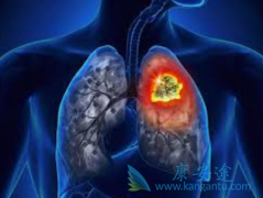 ���ô������(Dacomitinib)�Ļ���Ӧ���˽�������ص�