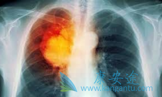 ��Сϸ���ΰ�