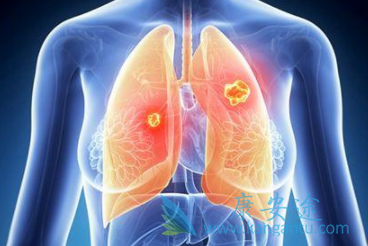 ��Сϸ���ΰ�