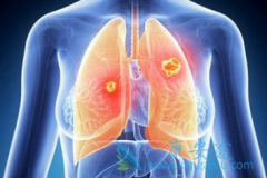 ������������������ͻ�����͵ķ�Сϸ���ΰ�����ҩ��