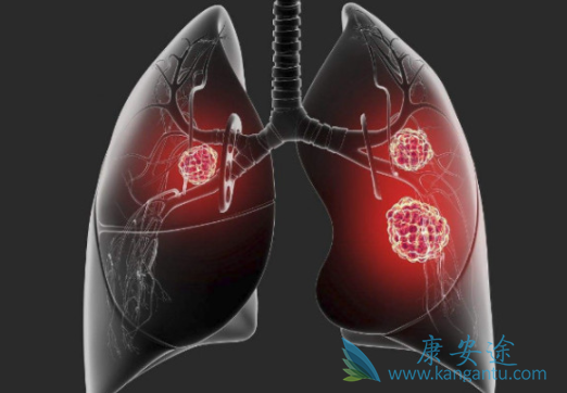 恩沙替尼 恩沙替尼