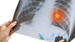 ALK���Էΰ����߿�������������ֱ�ӷ��ð���������