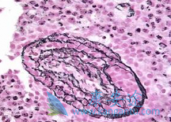 ����Ī����(Zevalin)���ӳ�Bϸ���ܰ������߶�õ������ڣ�