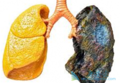 ������ͪ�����ط��Է���ά��Ч����ô��