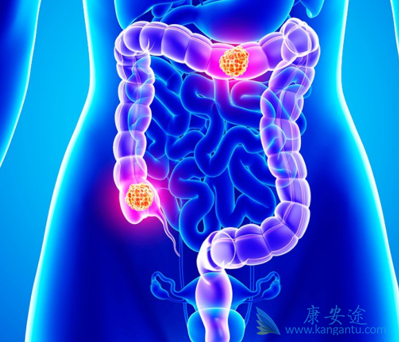 ��ֱ����