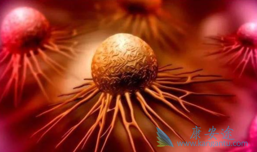 妇科癌症 妇科癌症