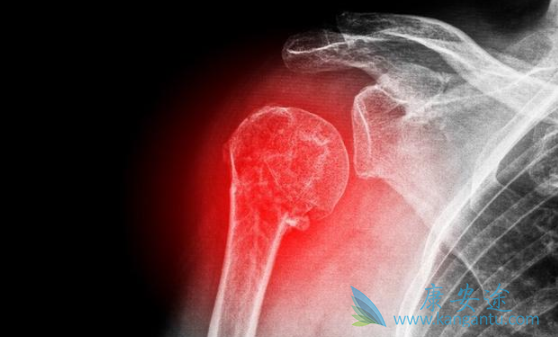 卡博替尼 卡博替尼