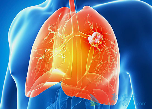 凡德他尼 凡德他尼