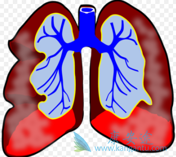 肺动脉高压症状 肺动脉高压症状
