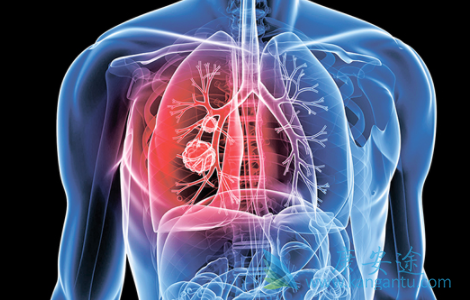 安罗替尼 安罗替尼