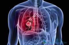 ���ڷ�Сϸ���ΰ�����ʹ��PD1����ǰ��������Ҫע��