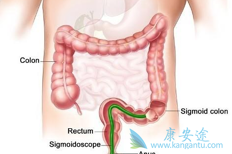 ��ֱ����