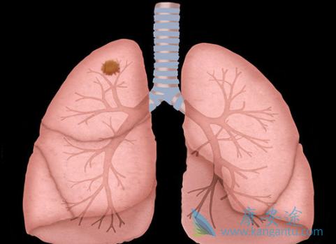 ��Сϸ���ΰ�