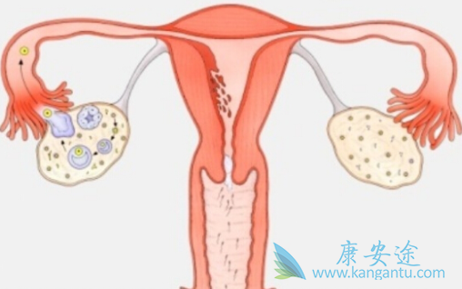 ³������