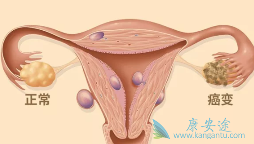 ³������