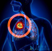 �������鵥��(Keytruda)�Բ�ͬ���ͷΰ����ߵ�OS���ڲ�����