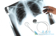 �������(VIZIMPRO)��ȼ�����������Щ���ƣ�