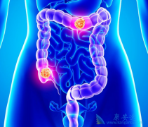 ��������(Avastin)���Ϸ���ऺ������濵��RASҰ���ͽ�ֱ����������