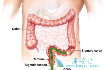 帕尼单抗 帕尼单抗