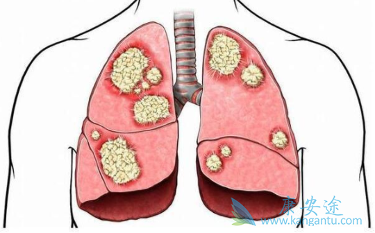 ��Сϸ���ΰ�