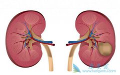 �������������ļ���TKI��ҩ�����