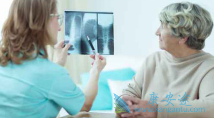 多发性骨髓瘤 多发性骨髓瘤