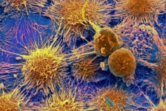 ����Keytruda�ΰ�������ҩ�ﻹ����Щ��