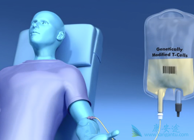 CAR-T治疗 CAR-T治疗