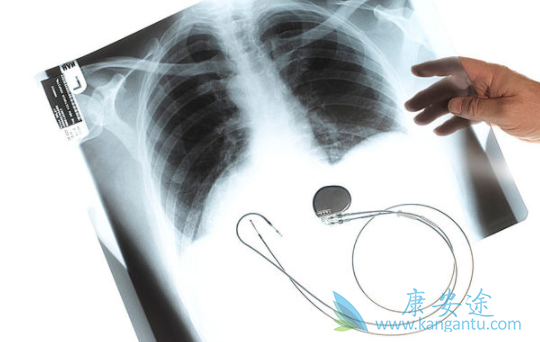 厄洛替尼 厄洛替尼