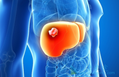 PD-1���Ƽ������ڸΰ���������û����Ч��