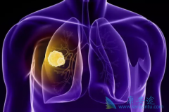 Atezolizumab��Сϸ���ΰ����߸������ҩ��