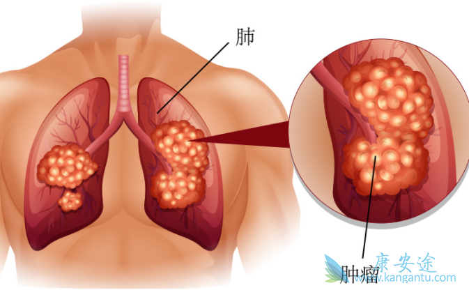 布吉他滨 布吉他滨