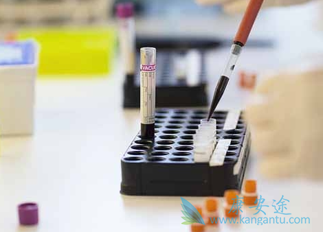 帕博西尼 帕博西尼