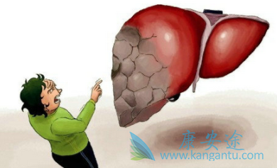 乙肝病毒 乙肝病毒