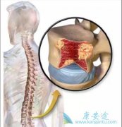 ���˶෢�Թ�����֮��Ի�����������ЩΣ����