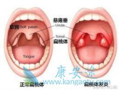 ���Ա�������������尩�����Ҫ����ʲô����