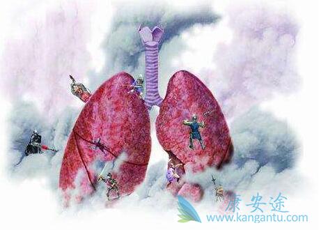 �ΰ����󸴷�