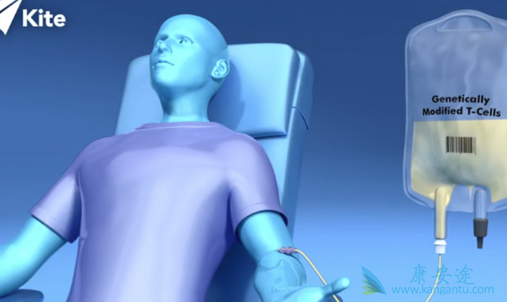 CAR-T细胞免疫治疗 CAR-T细胞免疫治疗