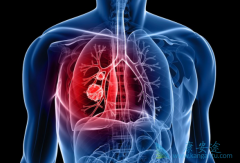 �ϼ����沼������(Brigatinib)������Ч�ø�����С�۸񻹺�������