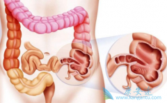 Ϊʲô������/�����������Բ��ִ󳦰�������Ч��