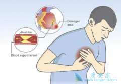 ��������������ΰ�֢״ʱ���ܻ����Ѵ��ڷΰ�����